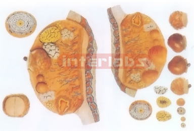 MAGNIFIED MODEL OF THE OVARY